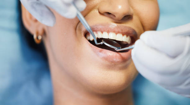 Best Emergency Cosmetic Dentistry (e.g., broken veneers) in Bass Lake, IN